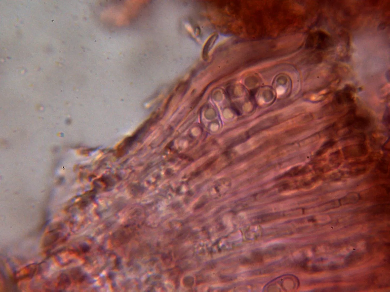 Microscopía de Lecidea lithophila - 11 - Asca 1